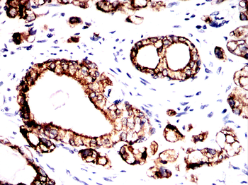 KRT8 Antibody