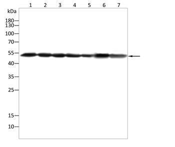 KRT8 Antibody