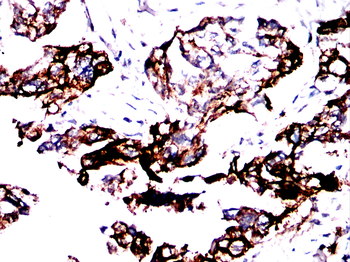 KRT18 Antibody