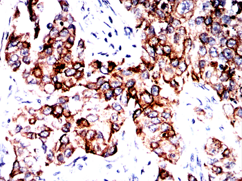 KRT18 Antibody