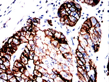 KRT18 Antibody