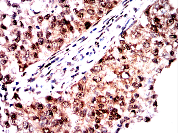HSPA8 Antibody