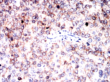 PRKAA1 Antibody