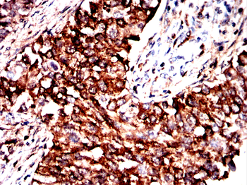 MICU1 Antibody