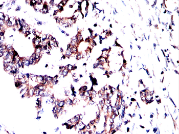 MICU1 Antibody