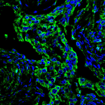 MICU1 Antibody