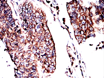 MICU1 Antibody