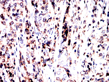 MICU1 Antibody