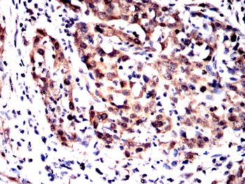 GSK3B Antibody