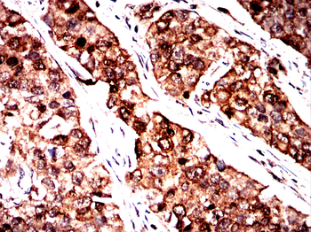 CDK5 Antibody