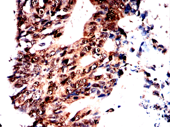 CDK5 Antibody