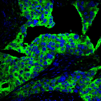 CDK5 Antibody