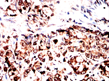 CDK5 Antibody