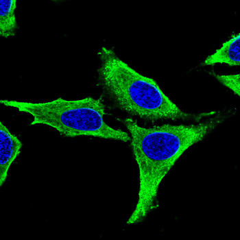 TUBB Antibody