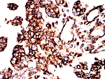 TUBB Antibody