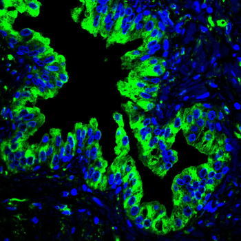 TUBB Antibody