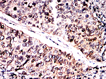 TUBB Antibody