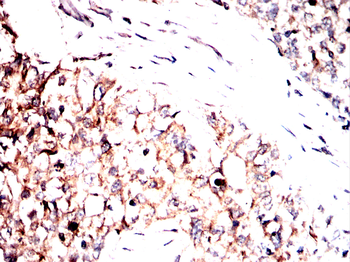 TUBB Antibody