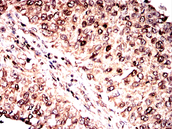 MAPK3,MAPK1 Antibody
