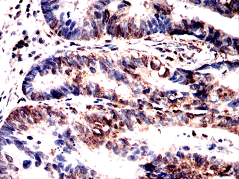 MAPK3,MAPK1 Antibody