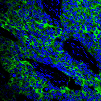 MAPK3,MAPK1 Antibody