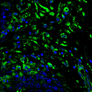 MAPK3,MAPK1 Antibody