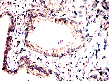 MAPK3,MAPK1 Antibody