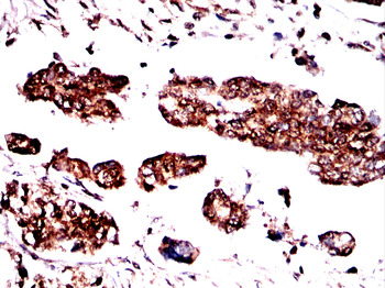 NFKB1 Antibody