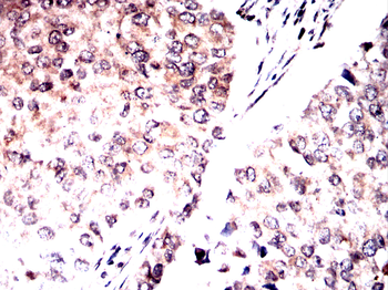 NFKB1 Antibody