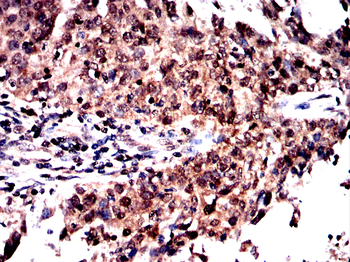 NFKB1 Antibody