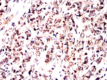 NFKB1 Antibody