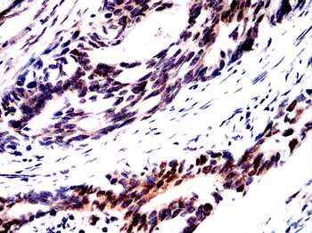 NFKB1 Antibody