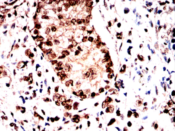 GSK3B Antibody