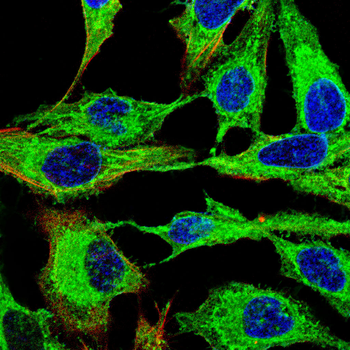 STAT3 Antibody