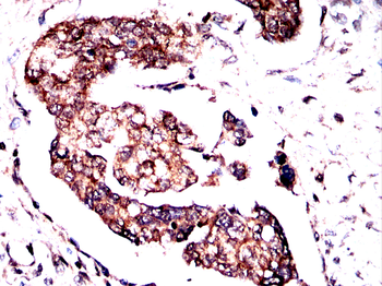 STAT3 Antibody