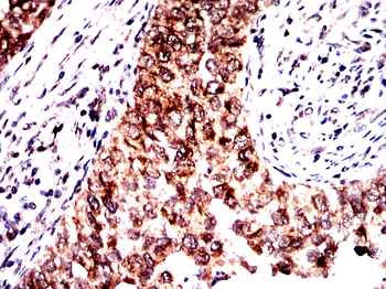 STAT3 Antibody