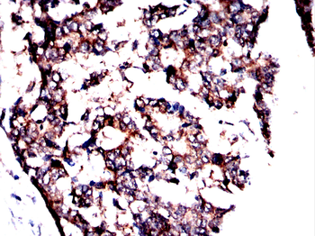 STAT3 Antibody