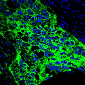 STAT3 Antibody