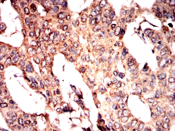 LRP1 Antibody