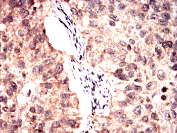 LRP1 Antibody