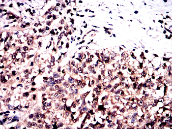 LRP1 Antibody