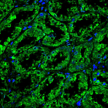 LRP1 Antibody