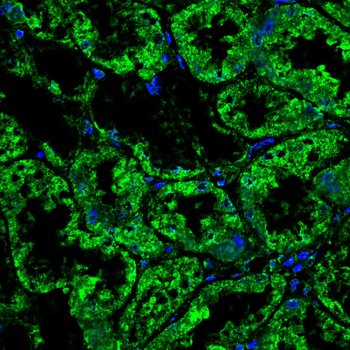 LRP1 Antibody