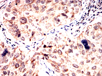 LRP1 Antibody