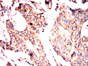 RAPGEF3 Antibody