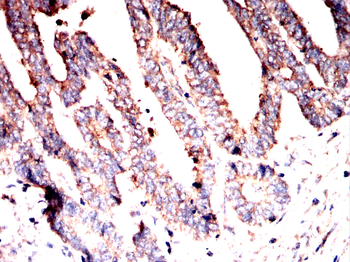 RAPGEF3 Antibody
