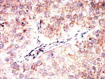 RAPGEF3 Antibody