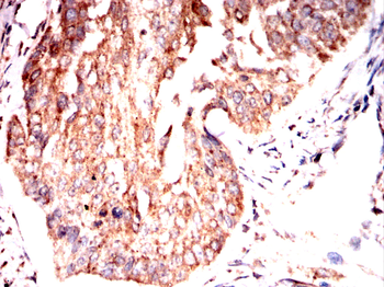 RAPGEF3 Antibody