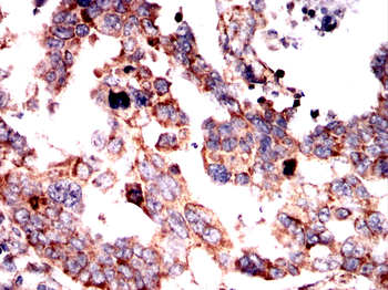 RAPGEF3 Antibody