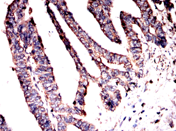 RAPGEF3 Antibody